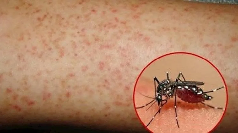 Trường MIS tuyên truyền phòng chống sốt xuất huyết